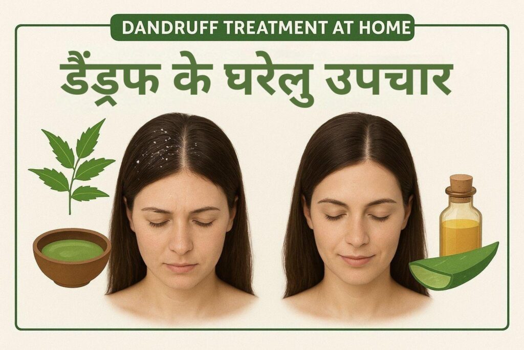 Dandruff treatment at home